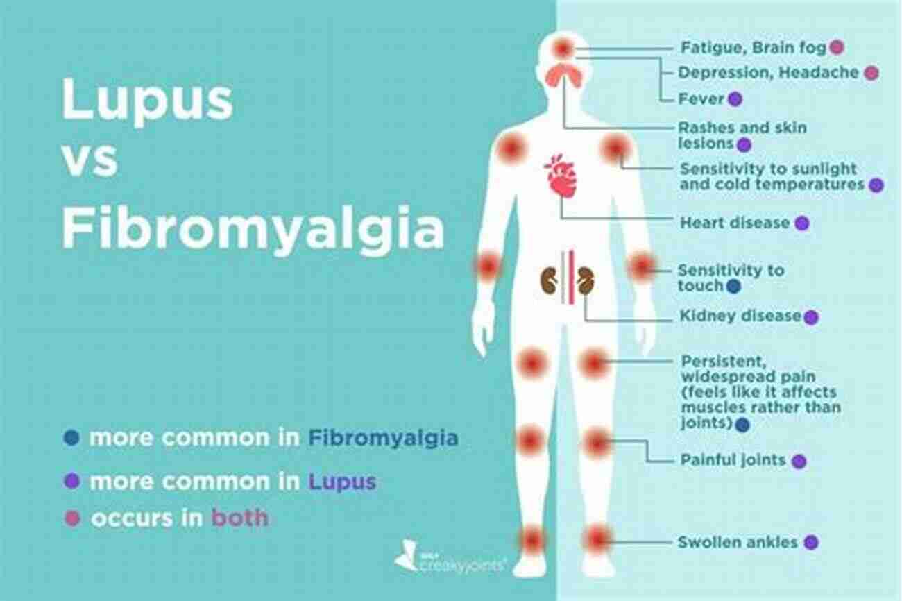 Conquering Chronic Diseases Lupus And Fibromyalgia While Maintaining Vitality Beyond The Fighter: Conquering Chronic Diseases Lupus And Fibromyalgia While Maintaining Vitality