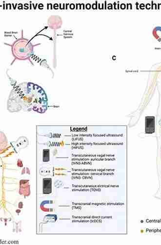 Neuromodulation Techniques For Pain Treatment: A Step By Step Guide To Interventional Procedures And Managing Complications